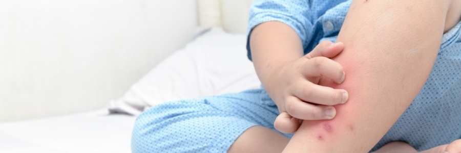 學古人這樣驅(qū)蚊，從此不再“蚊”風喪膽！