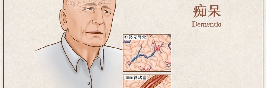 “馬什么梅？”年紀(jì)輕輕老忘事，竟是癡呆的前兆？！