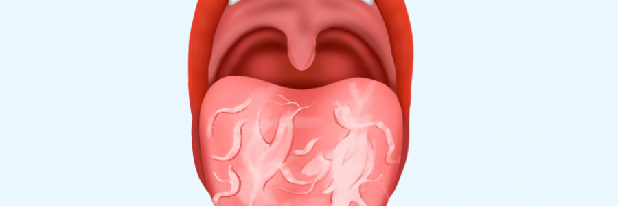 舌苔辨識“九種中醫(yī)體質(zhì)”（配圖）