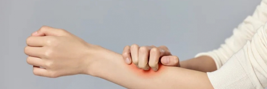 濕疹、瘙癢、蕁麻疹……患皮膚病，也許是好事！